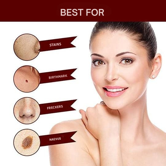 Wart Remover | Precision Applicator for Spot Treatment | Plant-Based Care Formula