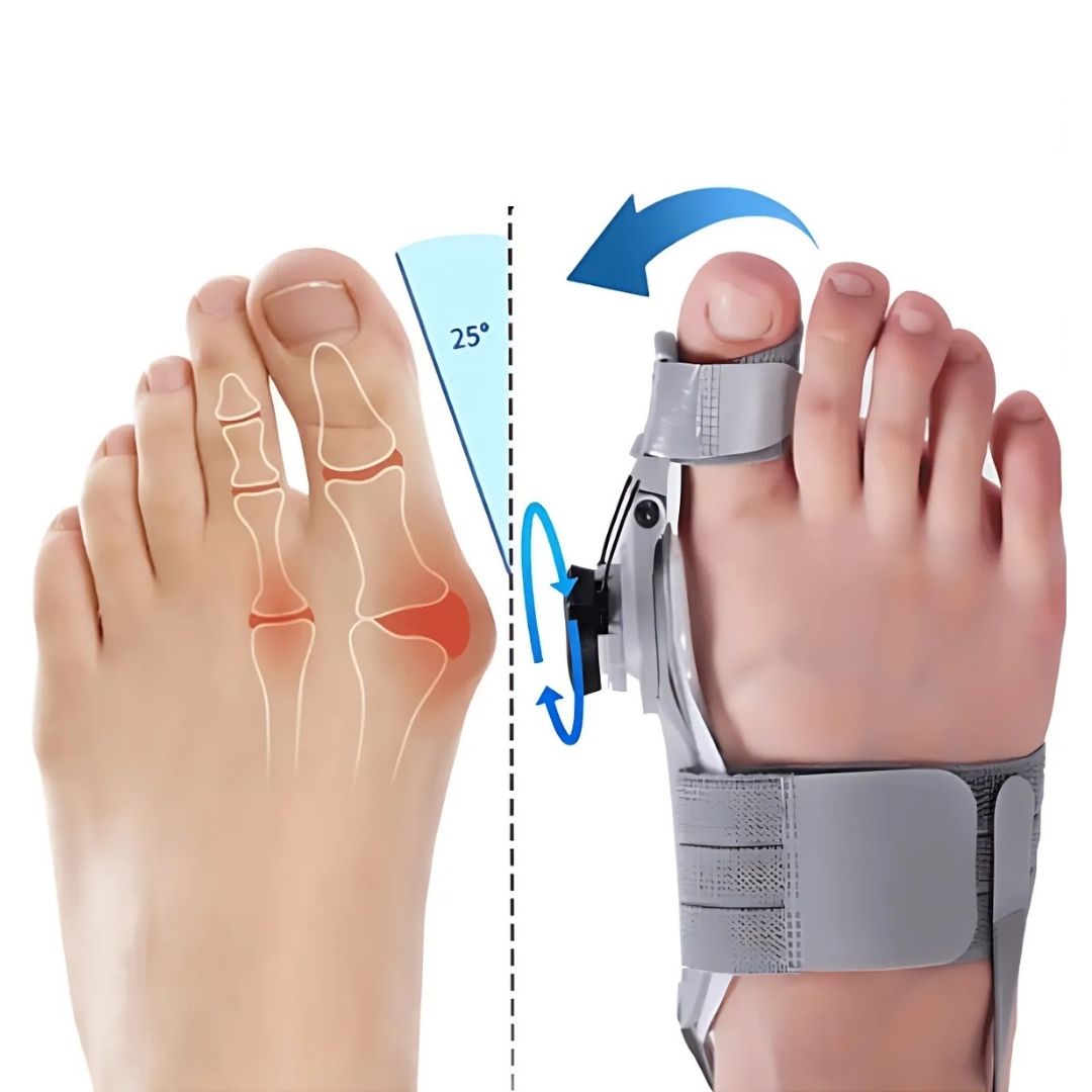 Adjustable Relief Supports | Hallux Valgus Corrector