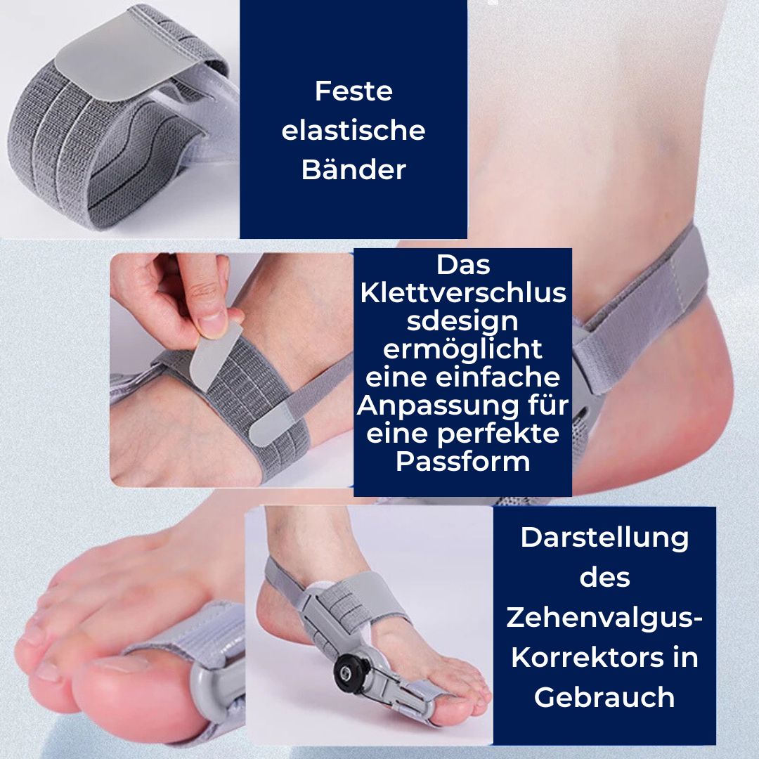 Adjustable Relief Supports | Hallux Valgus Corrector