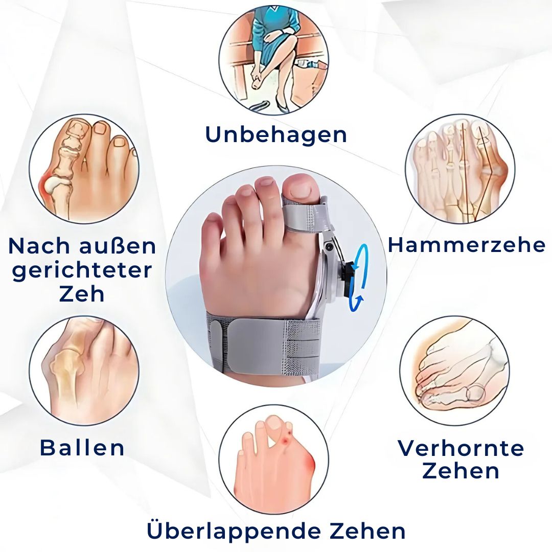 Adjustable Relief Supports | Hallux Valgus Corrector