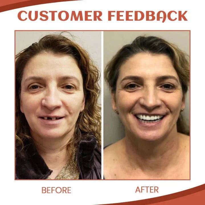 Adjustable Silicone Denture Set for a Natural Smile