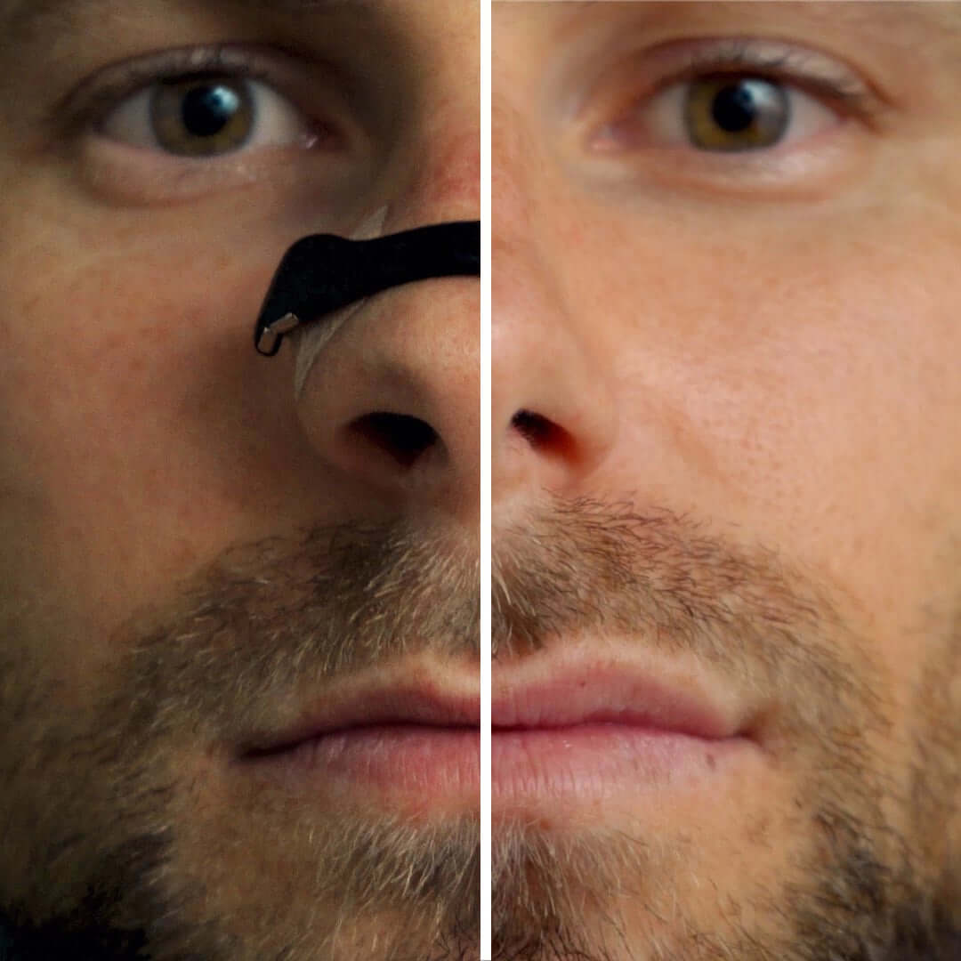 Airo Magnetic Nose Band Set - The New Standard for Breathing
