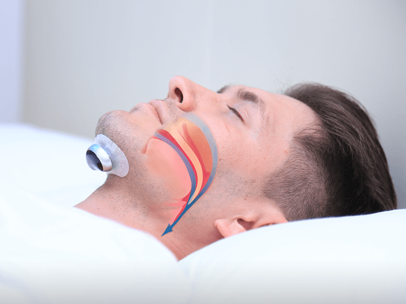 Anti-snoring device for peaceful nights