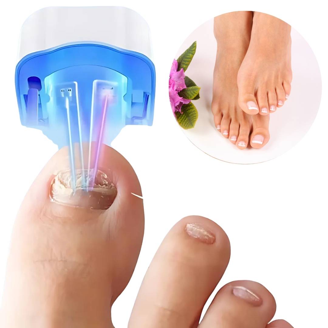 ClearNagel Pro - Nail Fungus Laser Device - Pain-Free - Effective