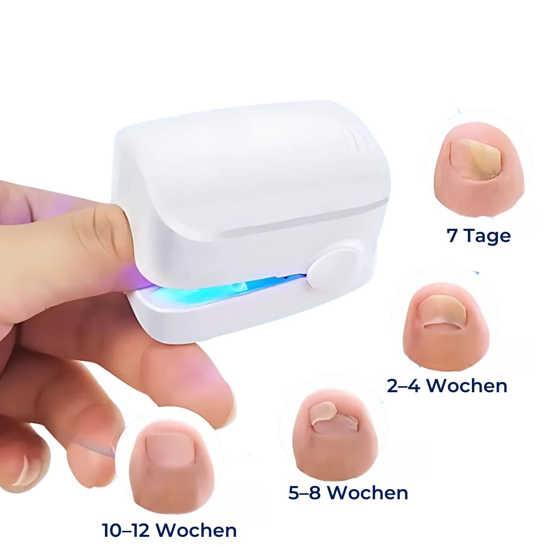 ClearNagel Pro - Nail Fungus Laser Device - Pain-Free - Effective