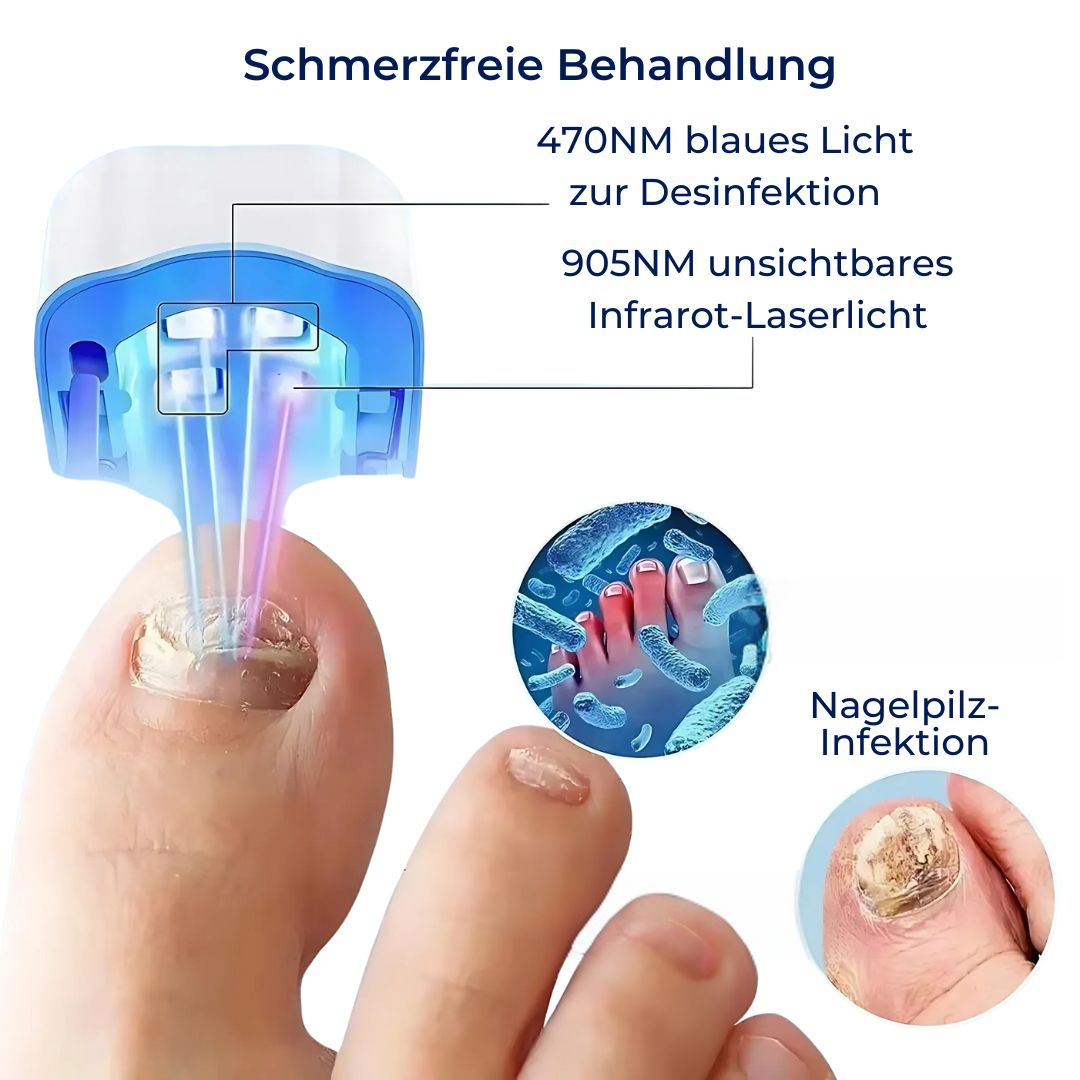 ClearNagel Pro - Nail Fungus Laser Device - Pain-Free - Effective