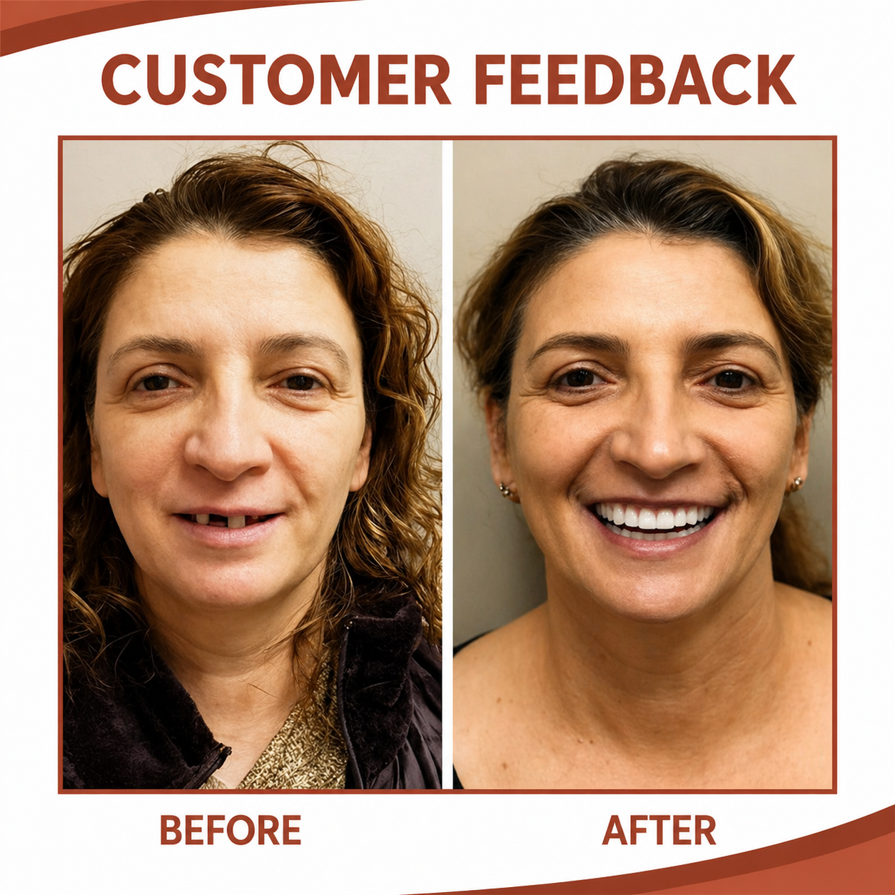 Dentures | Soft Silicone Cushion | Non-Slip Fit Without Pressure Points | SecureSmile