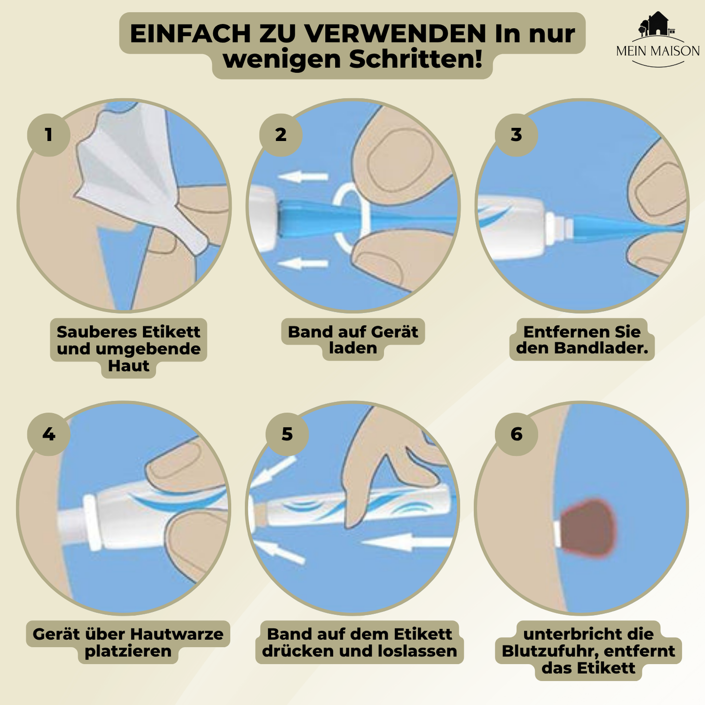 DermaLinx Wart Remover | Pain-Free Removal of Warts & Moles | For Home | Without Surgery