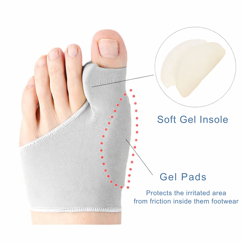 Hallux Valgus | Toe Corrector | Pressure Relief While Walking