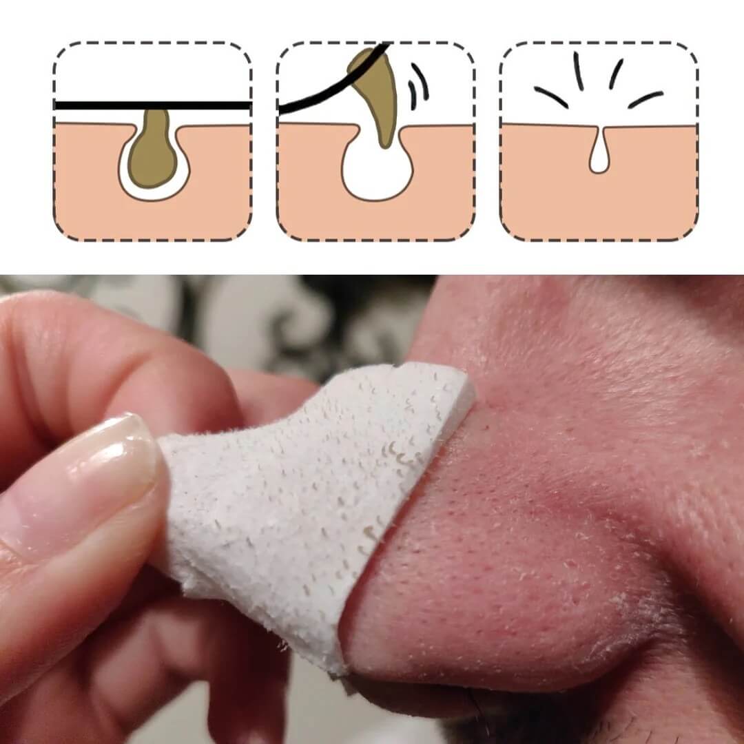 LANBENA face mask for blackheads