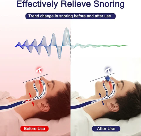 Micro CPAP Machine for Travel & Snoring - Medical Silicone