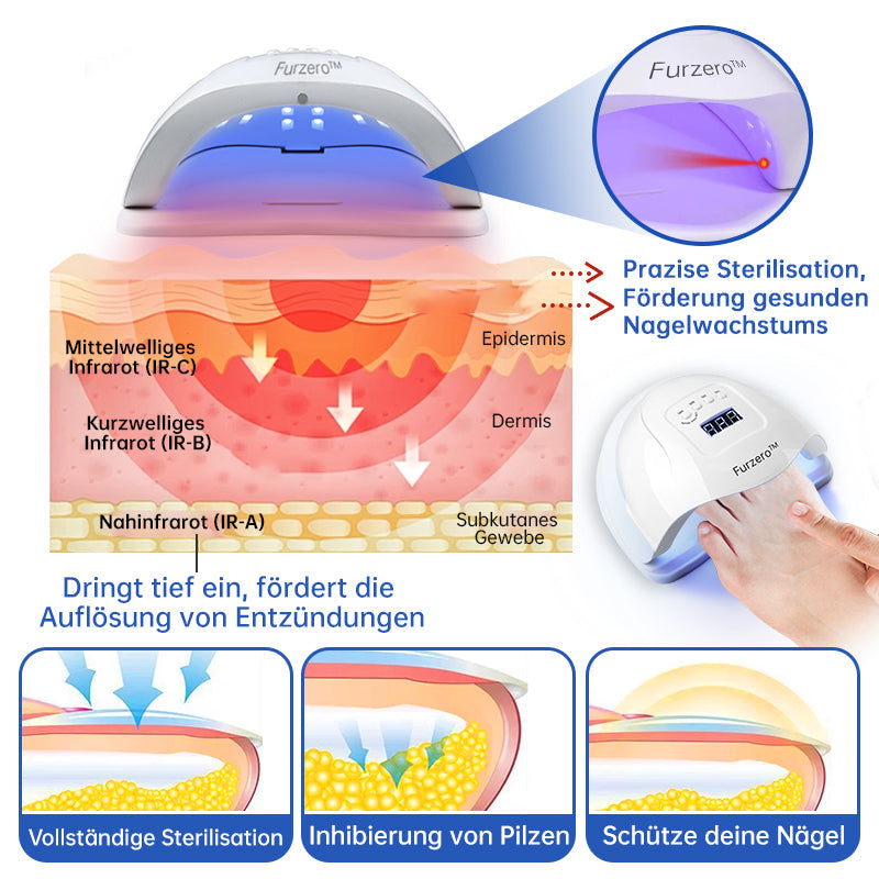 NailCure™ - Laser Treatment Solution for Nail Fungus (50% DISCOUNT)