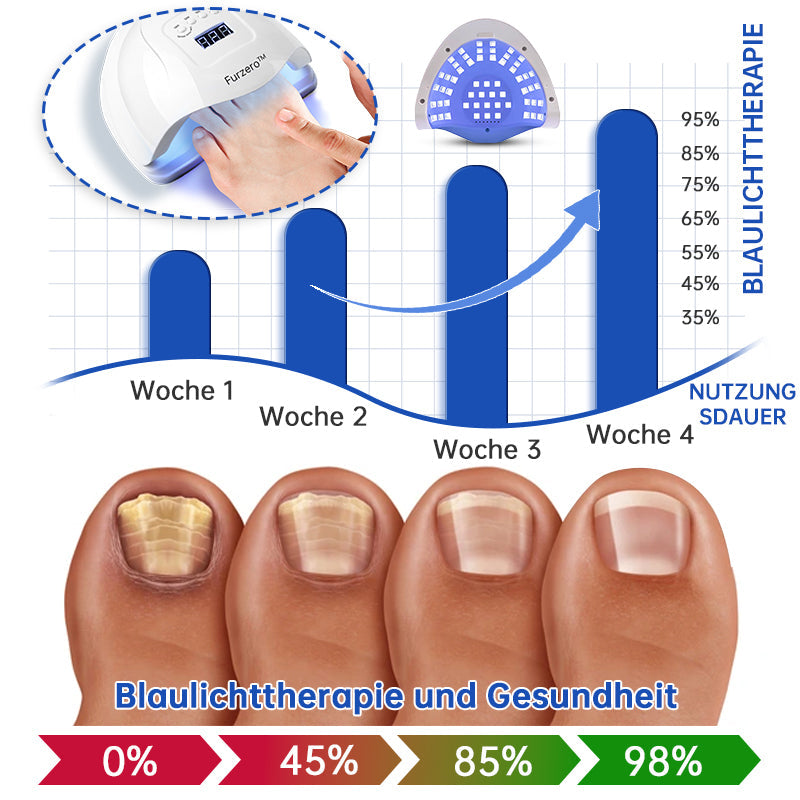 NailCure™ - Laser Treatment Solution for Nail Fungus (50% DISCOUNT)