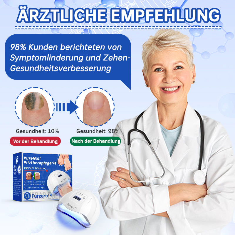 NailCure™ - Laser Treatment Solution for Nail Fungus (50% DISCOUNT)