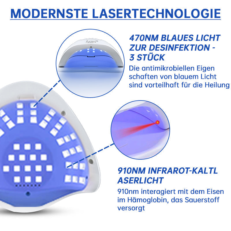 NailCure™ - Laser Treatment Solution for Nail Fungus (50% DISCOUNT)