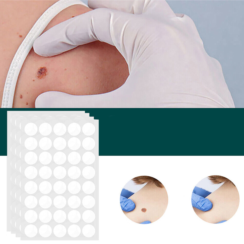 Patch for the removal of spots and warts
