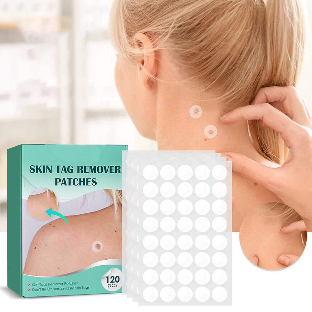 Patch for the removal of spots and warts