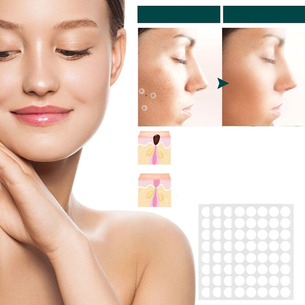 Patch for the removal of spots and warts