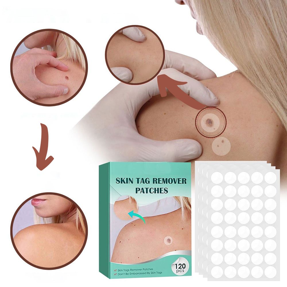 Patch for the removal of spots and warts