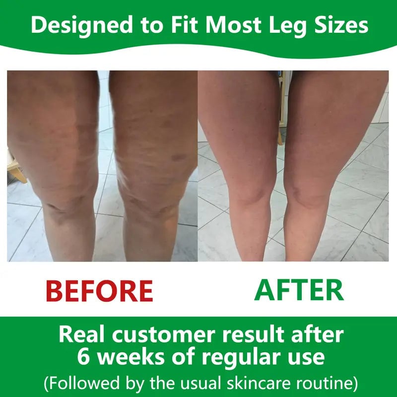 Sakerplus Cellulite Massage Roller