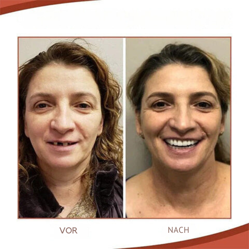 Silicone Dental Prosthetics for Comfortable, Natural Look