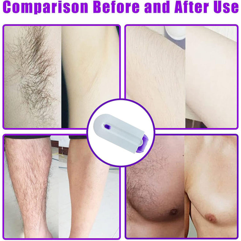 SmoothShaver - Multi-Purpose Smooth Gentle Pain-Free Hair Removal Shaver