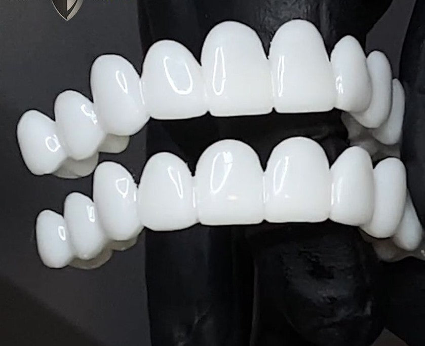 Snap-On Cosmetic Veneers | Instant Smile Cover for Imperfections